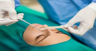 The Importance of Testing Before Nose Job Treatment