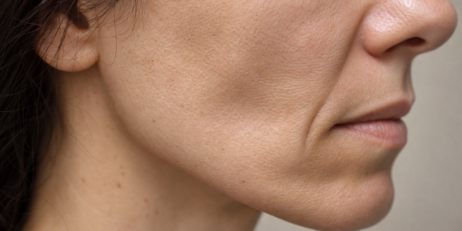 Facial changes after major weight loss showing skin, volume, and contour differences.